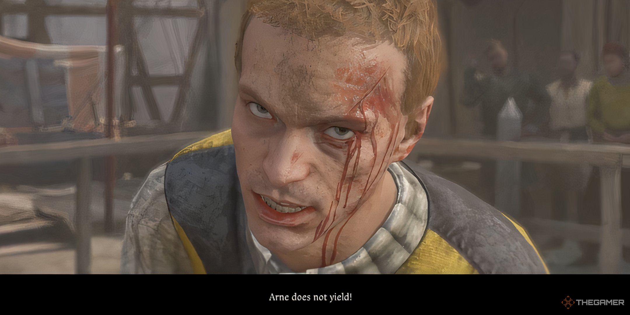 Wounded arne the sword fighter yelling arne does not yield in kingdom come deliverance 2.